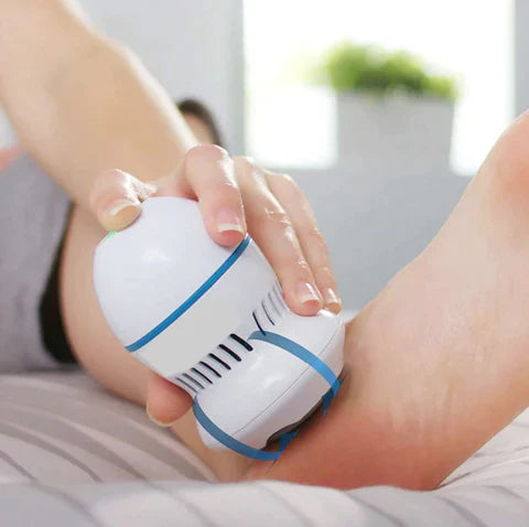 Thryve Vacuum Callus Remover