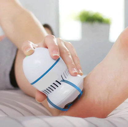 Thryve Vacuum Callus Remover